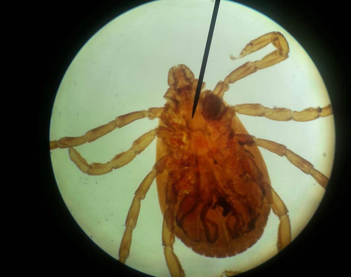 Tests de dépistage de la maladie de Lyme : moment, types, résultats